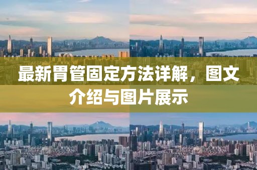 最新胃管固定方法详解，图文介绍与图片展示